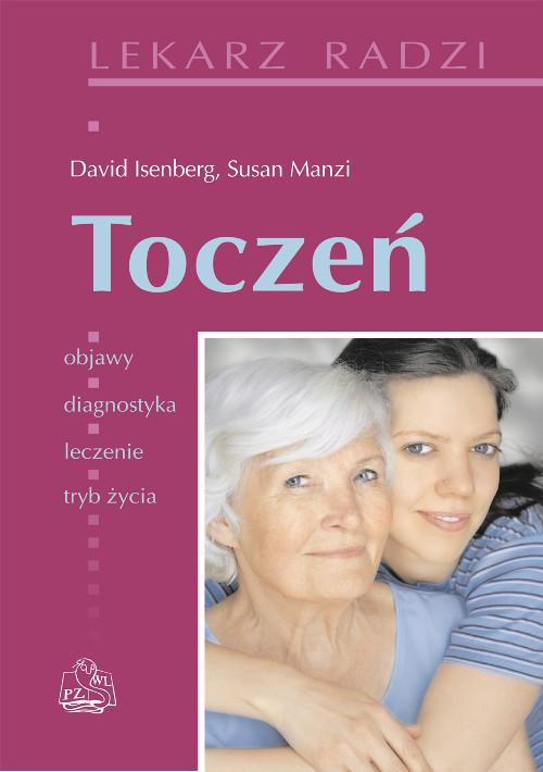 

Toczeń Isenberg David, Manzi Susan