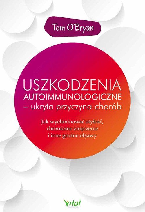 

Uszkodzenia autoimmunologiczne ukryta... O'Bryan