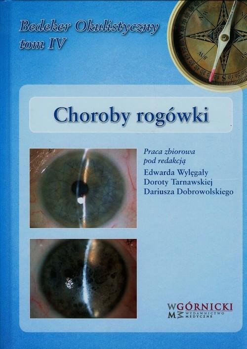 

Choroby rogówki Tom 4