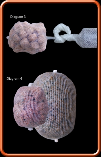 DOZA ZAPAS ESP DRENNAN SIATKA PVA 32mm - 6 m Marka ESP