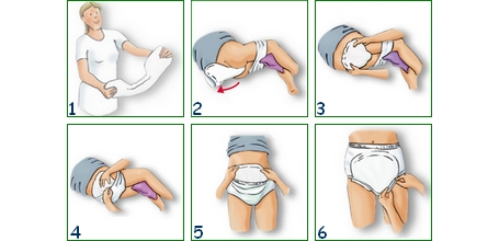 DIAPERS ANATOMICAL INSERTS LARGE SANITARY NAPS ABENA SAN 7 ABENA 30 pcs Type of medical device medical device or medical device for in-vitro diagnostics