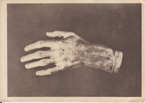 Odlew ręki Fr. Chopina /1949