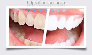 OPALESCENCE SENSITIVE RELIEF США ОТБЕЛИВАЮЩАЯ ПАСТА