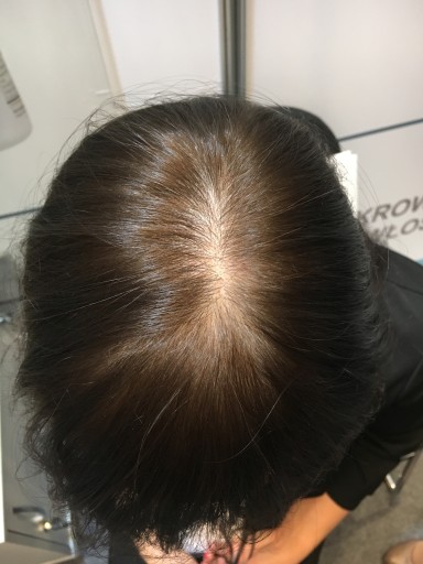 Na zagęszczenie włosów- mikrowłókna Hairmax