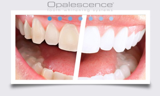 OPALESCENCE SENSITIVE RELIEF США ОТБЕЛИВАЮЩАЯ ПАСТА